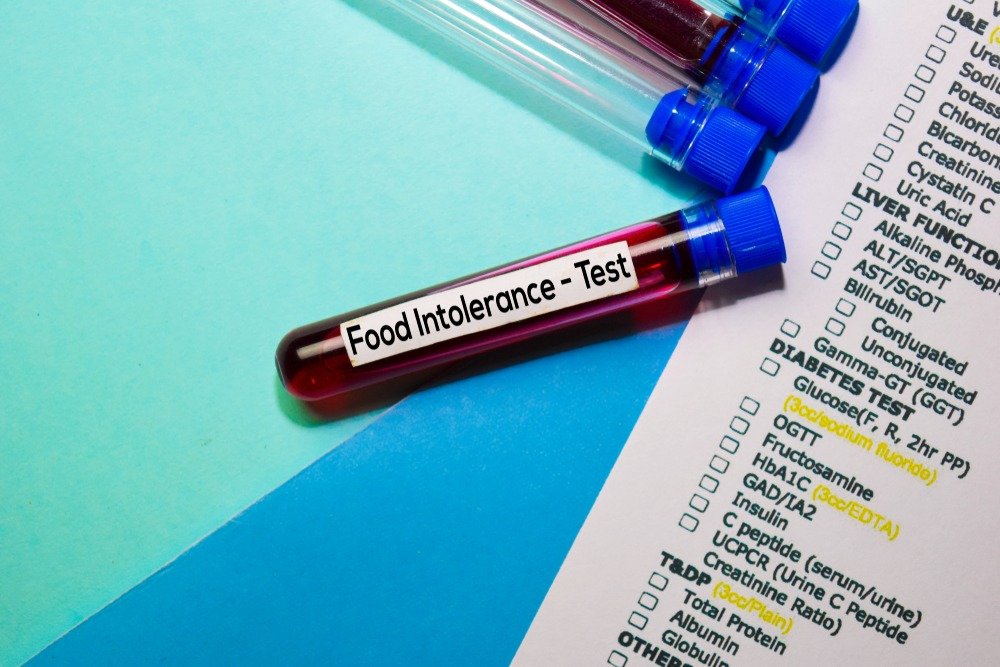 Food,Intolerance,-,Test,With,Blood,Sample.,Top,View,Isolated